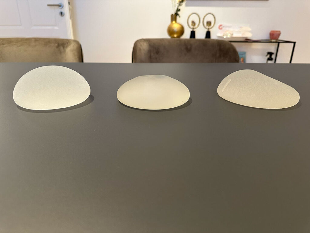 Brustvergrößerung mit Implantaten