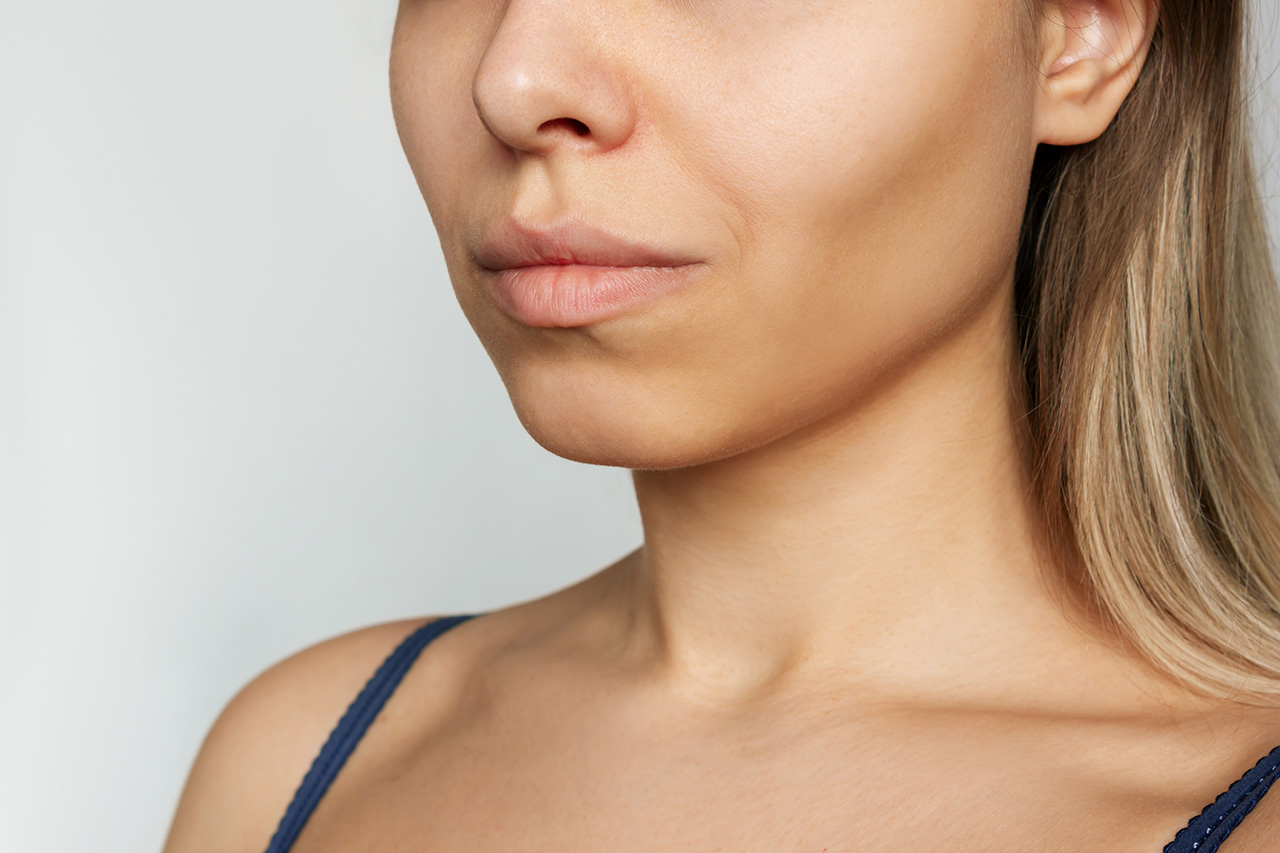 Buccal fat removal