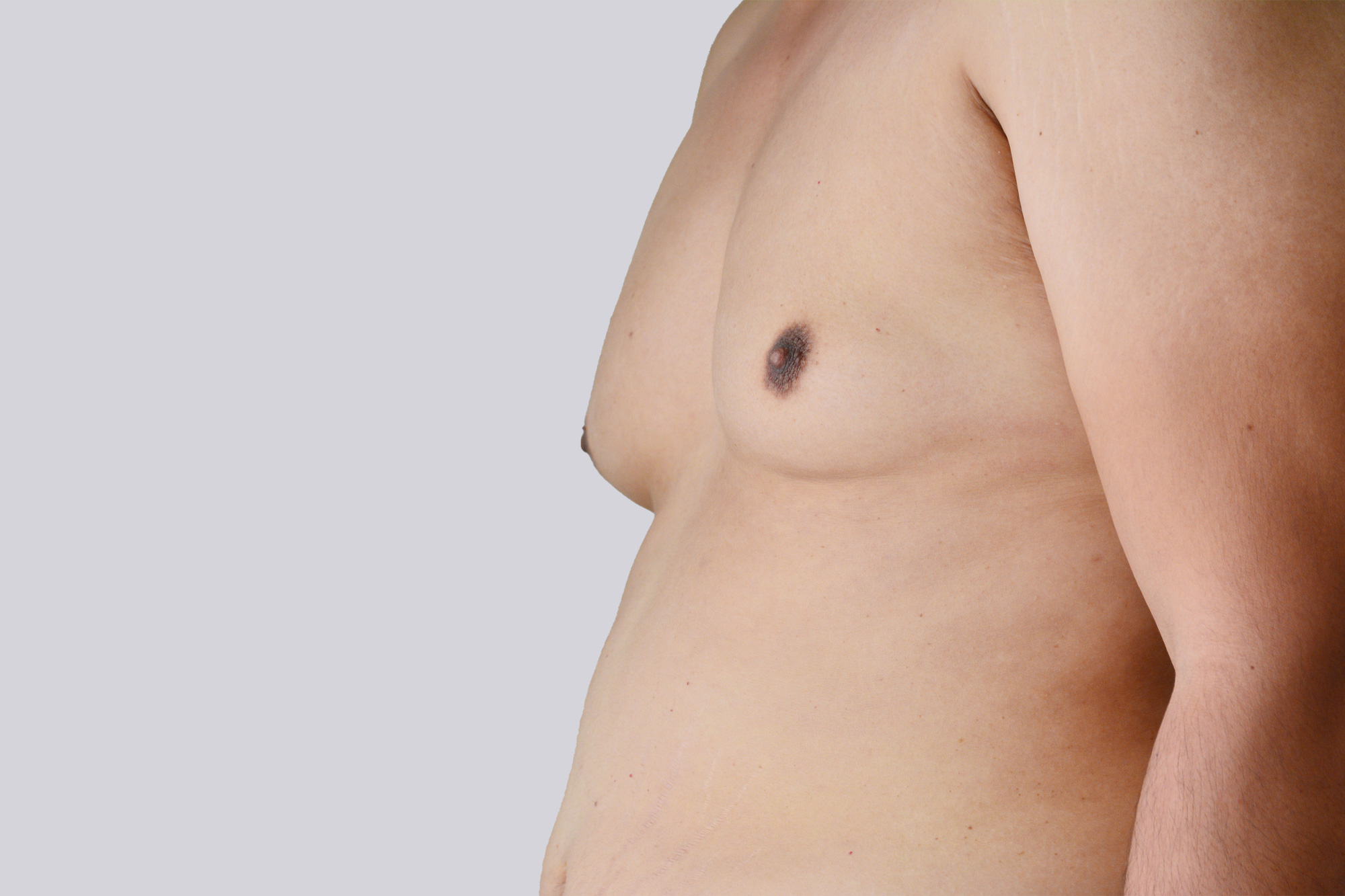 Plastische Chirurgie Frankfurt